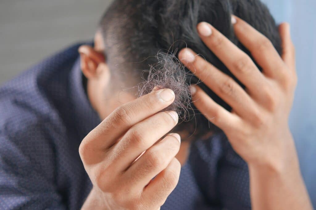 preventing and treating hair loss caused by ozempic semaglutide