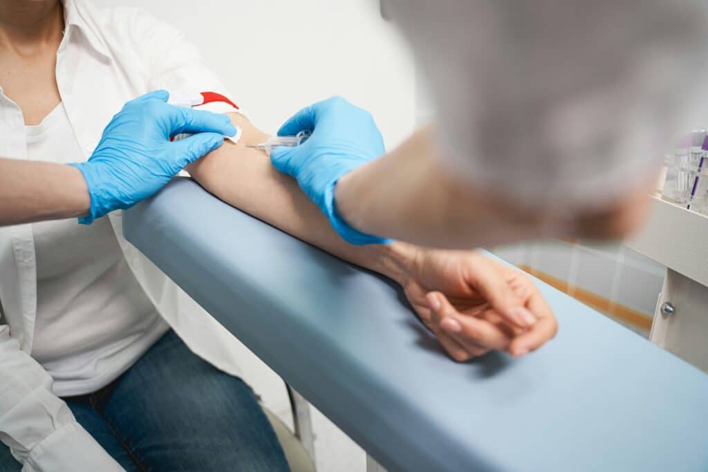 avoiding INR testing with DOAC