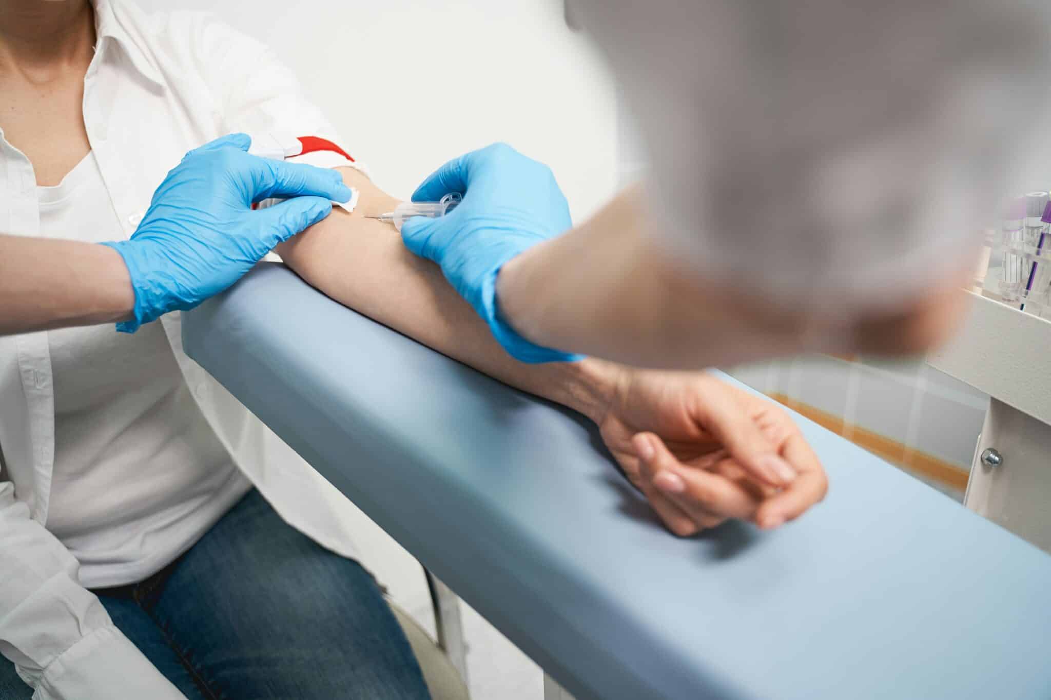 avoiding INR testing with DOAC