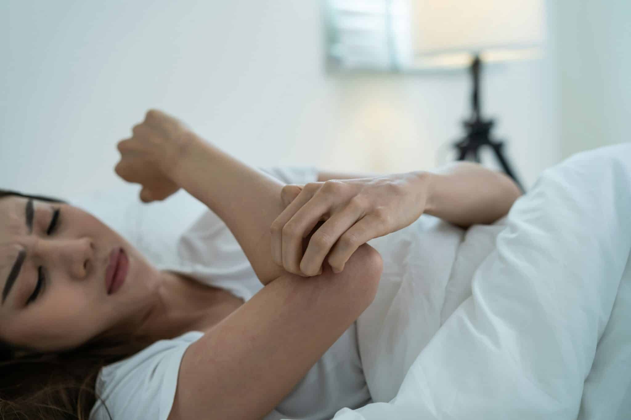 Woman in bed with Eczema